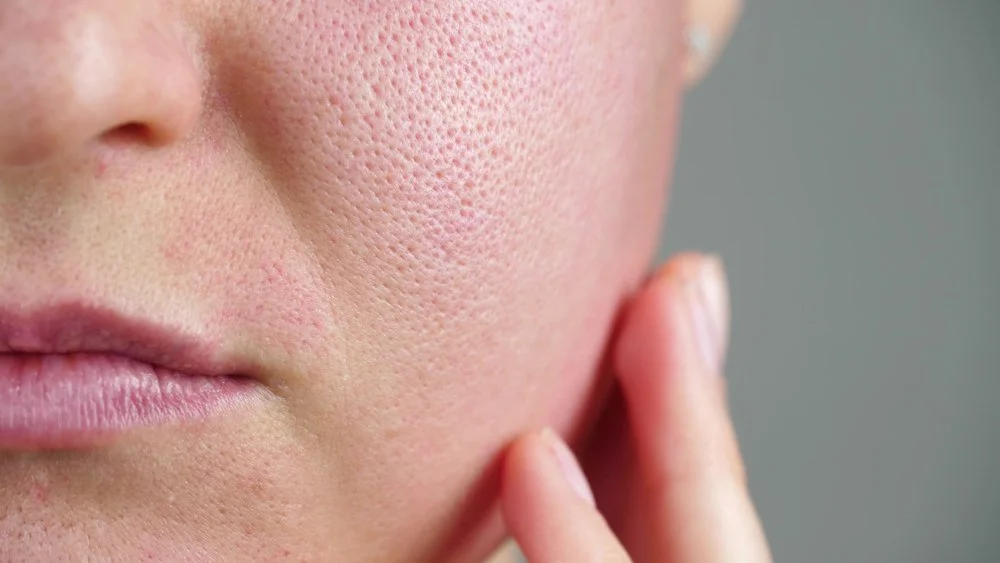 https://sonyadakar.com/blogs/the-s-room/how-to-get-rid-of-textured-skin
